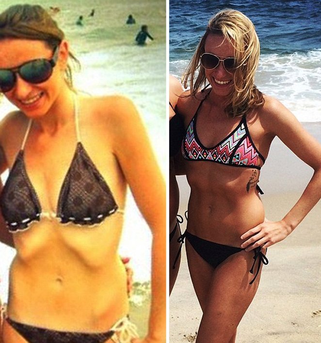 Η συγκλονιστική ιστορία μιας Βρετανίδας– Αρχισε δίαιτα στα 10, ζύγιζε 29 κιλά και έπαθε έμφραγμα στα 17 [εικόνες]  | iefimerida.gr 2