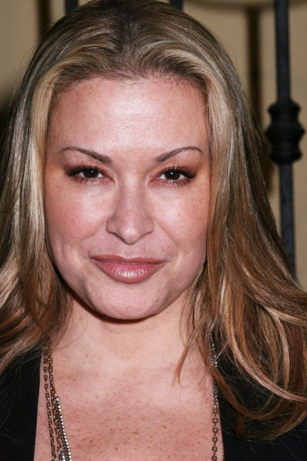 Anastacia: Είχα εθιστεί στο Botox -Εκανα κάθε τρεις μήνες [εικόνες]  | iefimerida.gr 6