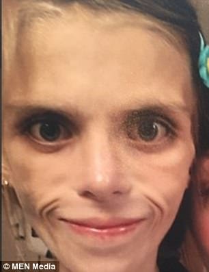 Η ιστορία της 15χρονης ανορεκτικής που συγκλονίζει τη Μ. Βρετανία -Αυτοκτόνησε μόλις βγήκε από την κλινική [εικόνες] | iefimerida.gr 1