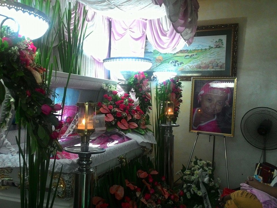 Εφυγε το «γηραιότερο κορίτσι» της Ασίας –Ηταν 19 ετών και έμοιαζε με 136 [εικόνες]  | iefimerida.gr 1