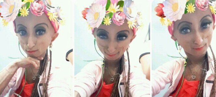 Εφυγε το «γηραιότερο κορίτσι» της Ασίας –Ηταν 19 ετών και έμοιαζε με 136 [εικόνες]  | iefimerida.gr 3