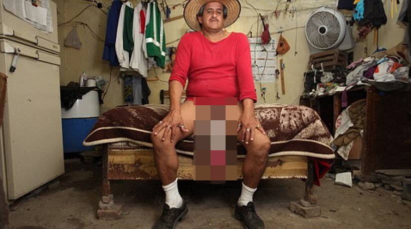 Επισήμως ανάπηρος ο άνδρας με το μεγαλύτερο μόριο στον κόσμο [εικόνες] | iefimerida.gr 1