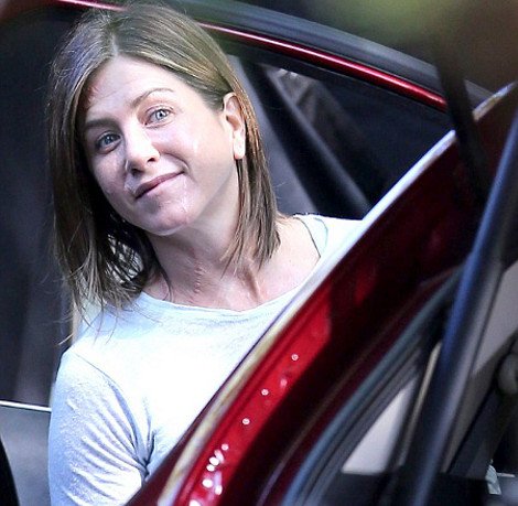 Τι συνέβη στην Τζένιφερ Ανιστον; -Εμφανίστηκε με βαθιές χαρακιές και ράμματα σε πρόσωπο και λαιμό [εικόνες] | iefimerida.gr 3