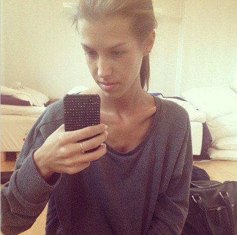 Καρέ-καρέ μέσα από 500 φωτογραφίες η μάχη μιας νεαρής με την ανορεξία -Πώς από τα 36 κιλά κατάφερε να γίνει φυσιολογική [εικόνες] | iefimerida.gr 12