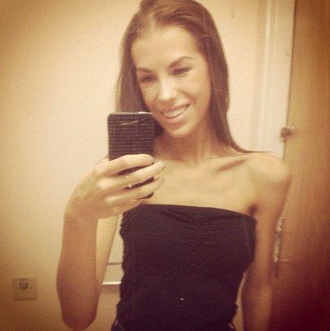 Καρέ-καρέ μέσα από 500 φωτογραφίες η μάχη μιας νεαρής με την ανορεξία -Πώς από τα 36 κιλά κατάφερε να γίνει φυσιολογική [εικόνες] | iefimerida.gr 13