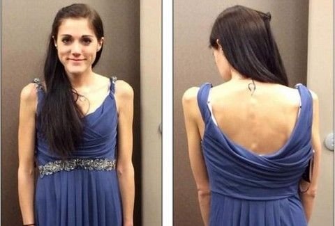 24χρονη στην εντατική -Εχει ένα χρόνο να φάει γιατί η δασκάλα την αποκάλεσε «χοντρή» [εικόνες] | iefimerida.gr 2