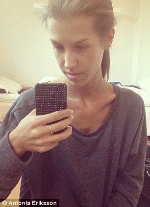 Ζυγίζει μόλις 38 κιλά και «φωνάζει» για τον εφιάλτη της ανορεξίας - Κατέγραψε τον Γολγοθά στο κινητό της [εικόνες & βίντεο] | iefimerida.gr 1