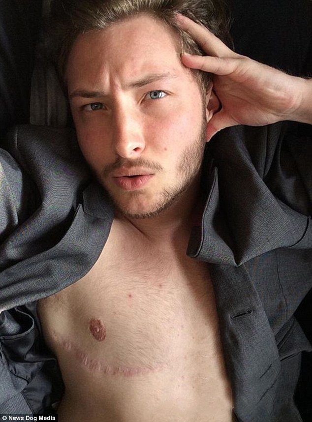 Η εστεμμένη καλλονή που έγινε άνδρας -Πήρε ορμόνες, έβγαλε το στήθος της [εικόνες] | iefimerida.gr 4