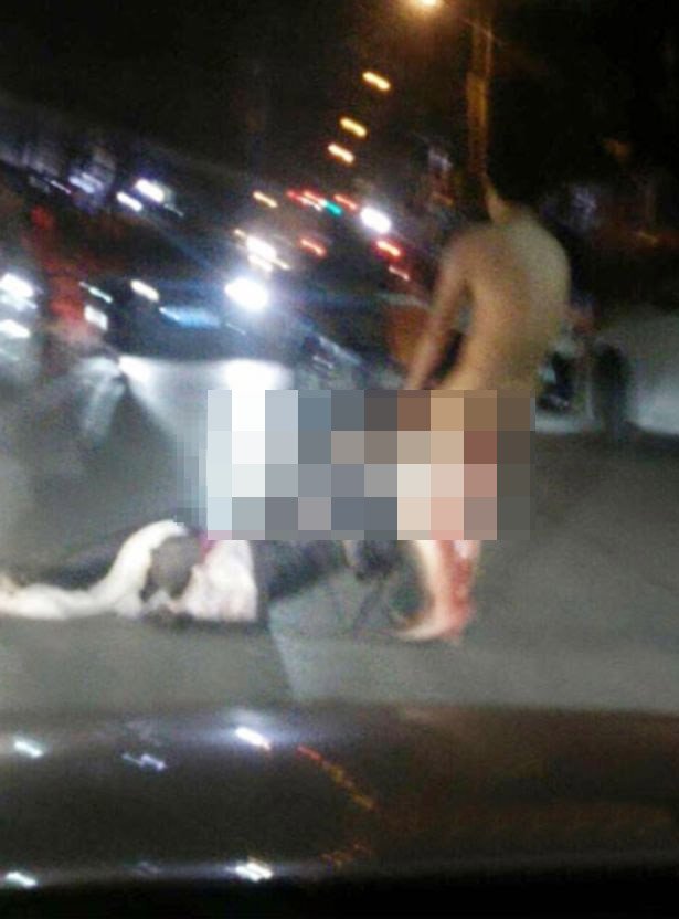 Φρικιαστική διπλή εκδίκηση: Του έκοψε το μόριο γιατί την απάτησε -Το συγκόλλησαν οι γιατροί και του το ξαναέκοψε [εικόνες] | iefimerida.gr 0