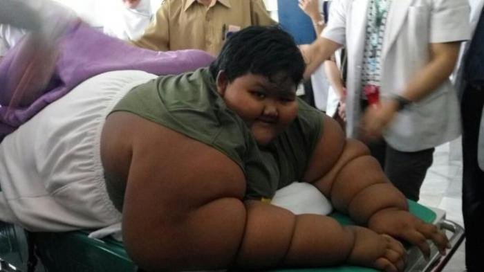 Ο 11χρονος που ζυγίζει 192 κιλά- Ο νεότερος που θα υποβληθεί σε εγχείρηση γαστρικού μανικιού [εικόνες & βίντεο] | iefimerida.gr 0