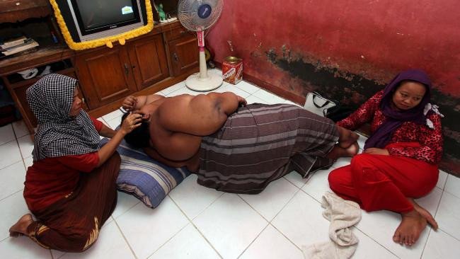 Ο 11χρονος που ζυγίζει 192 κιλά- Ο νεότερος που θα υποβληθεί σε εγχείρηση γαστρικού μανικιού [εικόνες & βίντεο] | iefimerida.gr 2