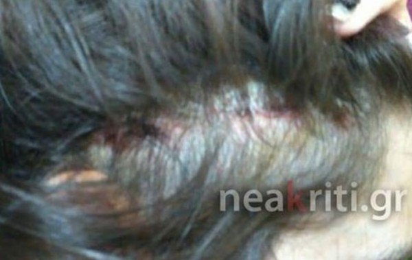 Απρόοπτο στη σχολική εκδρομή μαθητών από την Κρήτη στην Ιταλία -Τους έπεσε η οροφή στο κεφάλι [εικόνες] | iefimerida.gr 1