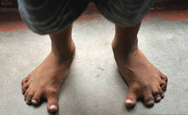 Αυτό είναι το παιδί με τα… 25 δάχτυλα [εικόνες] | iefimerida.gr 1