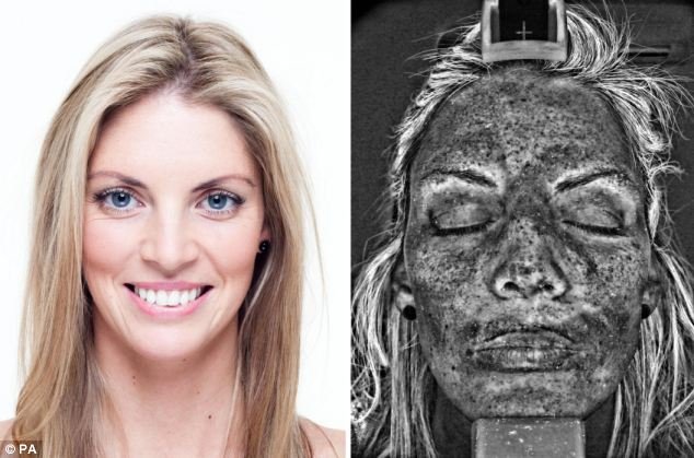 Πώς καίει το δέρμα το σολάριουμ: σοκαριστική έρευνα [εικόνα] | iefimerida.gr 0