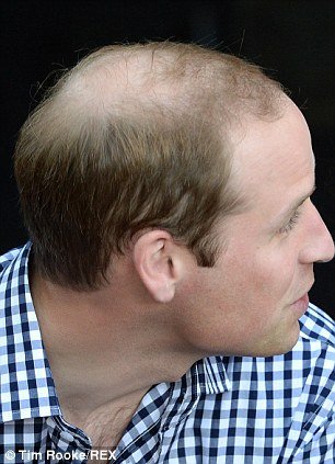 Γυάλισαν το «στέμμα» του Ουίλιαμ: Το Vanity Fair κατηγορείται ότι έκανε photoshop στη φαλάκρα του πρίγκιπα [εικόνες] | iefimerida.gr 1