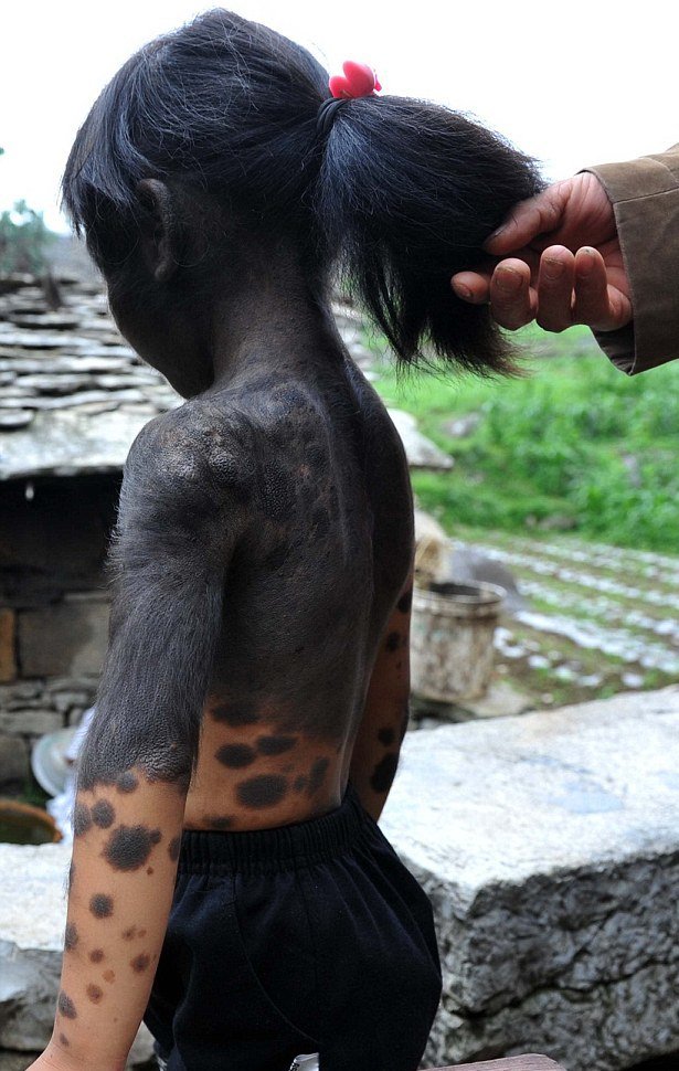 Την εγκατάλειψαν οι γονείς της επειδή γεννήθηκε με πυκνό τρίχωμα [εικόνες]  | iefimerida.gr 1