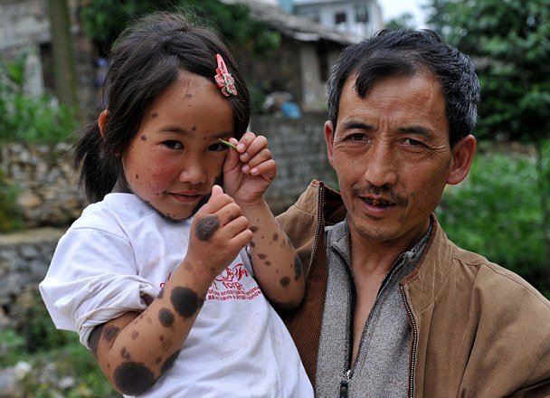 Την εγκατάλειψαν οι γονείς της επειδή γεννήθηκε με πυκνό τρίχωμα [εικόνες]  | iefimerida.gr 2