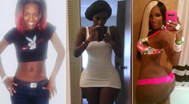 Μητέρα ξόδεψε 15.000$ σε «ενέσεις γλουτών» από την μαύρη αγορά [εικόνες] | iefimerida.gr 0