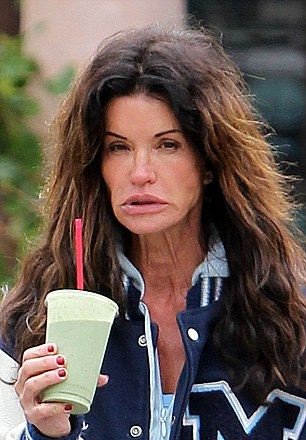  Το σουπερμόντελ που φαλίρισε εξαιτίας των πολλών πλαστικών [εικόνες]  | iefimerida.gr 1