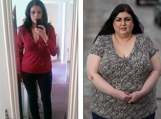 Η μυστηριώδης ασθένεια που έχει κάνει κόλαση τη ζωή μιας 34χρονης -Πήρε 50 κιλά σε έξι μήνες και σε λίγο δεν θα μπορεί να περπατήσει [εικόνες & βίντεο] | iefimerida.gr 5