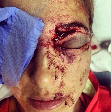 Αθλητής τραυμάτισε σοβαρά τη σύζυγό του με ένα... μπαλάκι του γκολφ [εικόνα] | iefimerida.gr 0