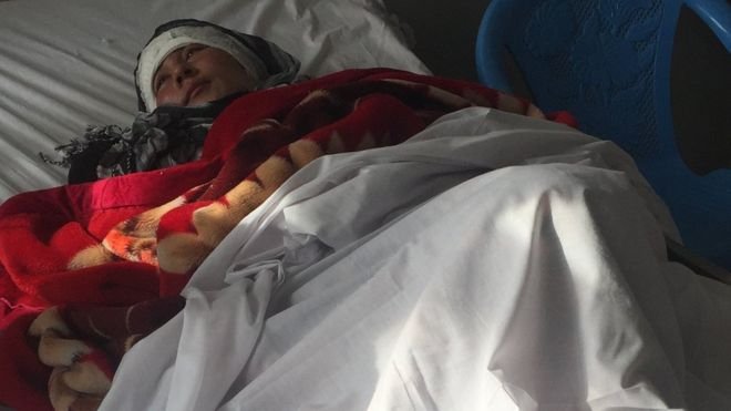 Aφγανός έκοψε και τα δύο αυτιά της 23χρονης συζύγου του [εικόνα] | iefimerida.gr 0