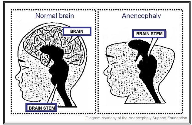 Εζησε μόλις 100 λεπτά και χάρισε ζωή -Η συγκινητική ιστορία του νεότερου δωρητή οργάνων [εικόνες] | iefimerida.gr 7