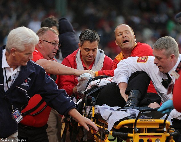 Ρόπαλο του μπέιζμπολ έσπασε και καρφώθηκε στο κεφάλι γυναίκας -Απίστευτος τραυματισμός [εικόνες] | iefimerida.gr 1