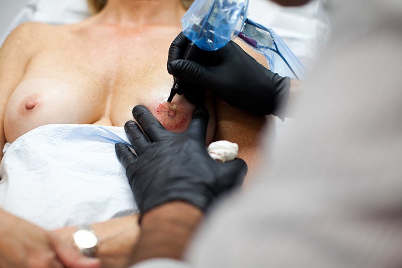 «Τατουατζής» αναπλάθει τις θηλές γυναικών που έχουν υποβληθεί σε μαστεκτομή [εικόνες] | iefimerida.gr 0