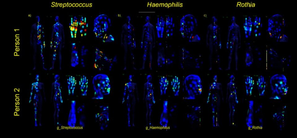 Ενας τρομακτικός χάρτης του ανθρώπινου σώματος: Πού συγκεντρώνονται τα βακτήρια [εικόνες] | iefimerida.gr 1
