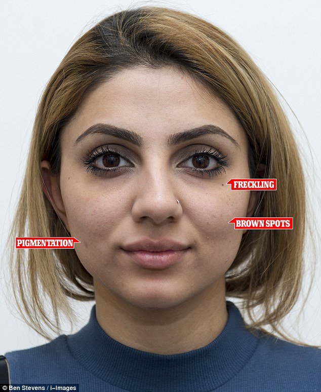  Γιατί οι selfie μπορούν να καταστρέψουν την επιδερμίδα σας [εικόνες & βίντεο] | iefimerida.gr 3