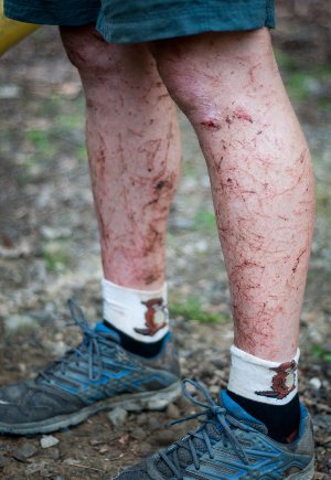 Αυτός είναι ο πιο δύσκολος και σκληρότερος αγώνας στον κόσμο -Ο εξαντλητικός μαραθώνιος που οδηγεί το σώμα στα άκρα [εικόνες&βίντεο] | iefimerida.gr 0