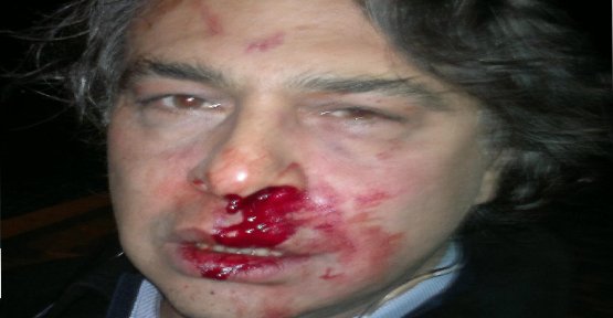 Ξυλοκόπησαν σχεδιαστή μόδας στην Κωνσταντινούπολη γιατί επέκρινε την κυβέρνηση [βίντεο] | iefimerida.gr 2