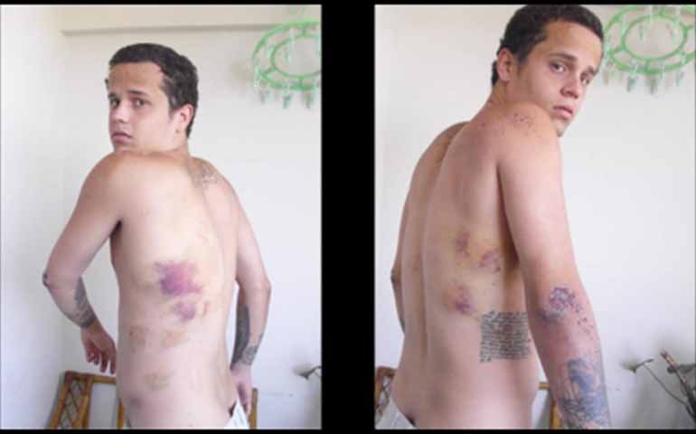 Θύματα βασανιστηρίων από το καθεστώς Μαδούρο μιλούν στο iefimerida – «Με βίασαν, μου έκαναν ηλεκτροσόκ, με μαστίγωσαν» [εικόνες] | iefimerida.gr 4