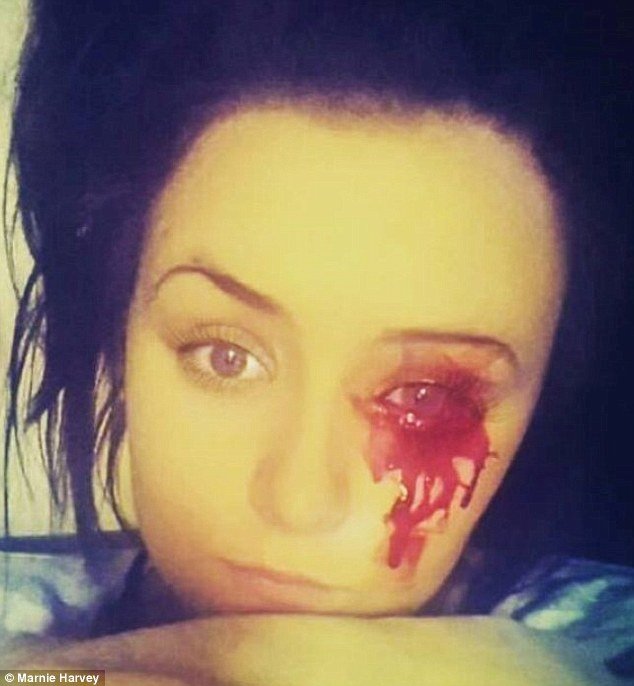 Κορίτσι... θρίλερ- Βγάζει αίμα από τα μάτια, τα αυτιά, τη γλώσσα και το κεφάλι στα καλά καθούμενα...  [εικόνες] | iefimerida.gr 4