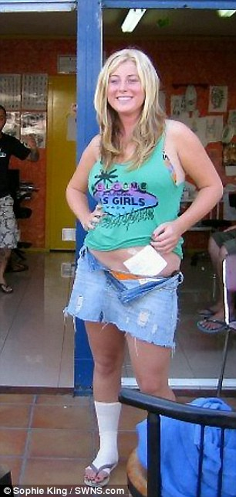 Νεαρή παχουλή μπλόγκερ χάνει... on line 25,6 κιλά και το γιορτάζει ανεβάζοντας φωτογραφίες με μαγιό [εικόνες] | iefimerida.gr 0