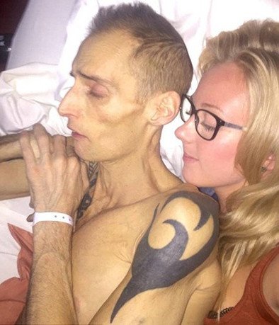 Μπόντι μπίλντερ πέθανε στα 39 του από καρκίνο στο συκώτι - Λάμβανε 10.000 θερμίδες την ημέρα και έπαιρνε στεροειδή [εικόνες]  | iefimerida.gr 6