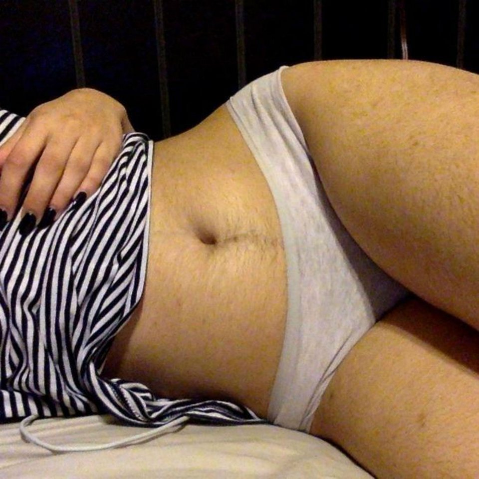 Εκανε selfie με τριχοφυία στην κοιλιά και δέχτηκε επίθεση στα social media [εικόνες] | iefimerida.gr 0