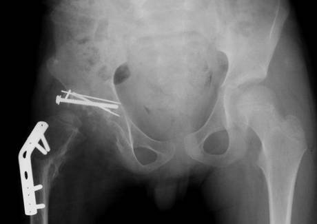 Κανίβαλος ή καλλιτέχνης; -Νορβηγός έφαγε μέρος του σώματός του εις το όνομα της τέχνης [εικόνα] | iefimerida.gr 0