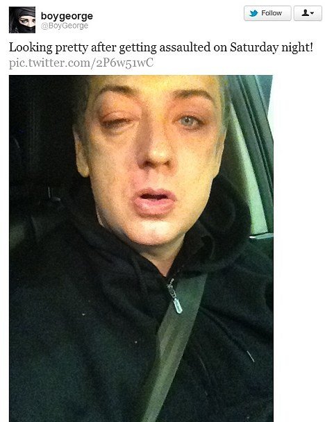 Θαυμάστρια, μαύρισε το μάτι του τραγουδιστή Boy George [εικόνες] | iefimerida.gr 0