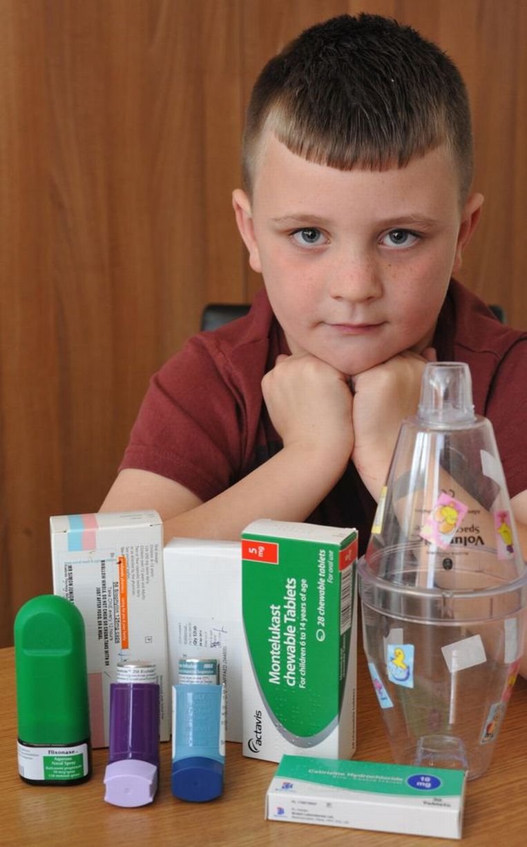 Ο 7χρονος που είναι αλλεργικός στον ...εαυτό του -Μια απίστευτη και σπάνια περίπτωση [εικόνες] | iefimerida.gr 0