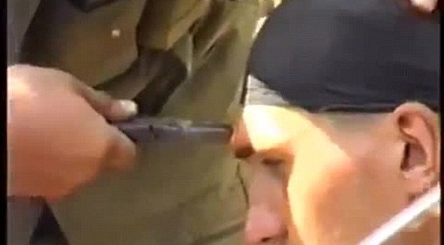 Απίστευτο-Του αφαιρούν σφαίρα από το μέτωπο με τανάλια και χαμογελάει [βίντεο] | iefimerida.gr 0