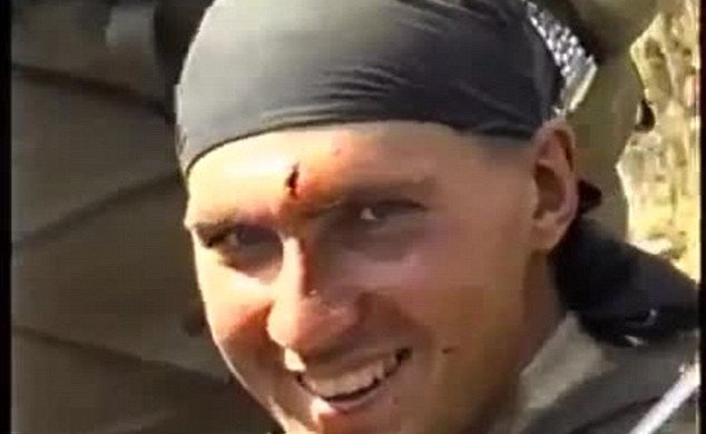 Απίστευτο-Του αφαιρούν σφαίρα από το μέτωπο με τανάλια και χαμογελάει [βίντεο] | iefimerida.gr 1