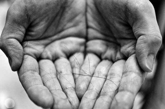 Eνας φωτογράφος απαθανατίζει συγκλονιστικά όλα τα στάδια του καρκίνου που πέρασε η γυναίκα του ως το τέλος [εικόνες] | iefimerida.gr 4