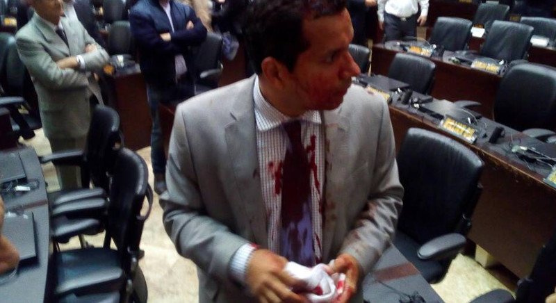 Βενεζουέλα: Οπαδοί του Μαδούρο εισέβαλαν στη Βουλή και τραυμάτισαν βουλευτές της αντιπολίτευσης [εικόνες] | iefimerida.gr 0