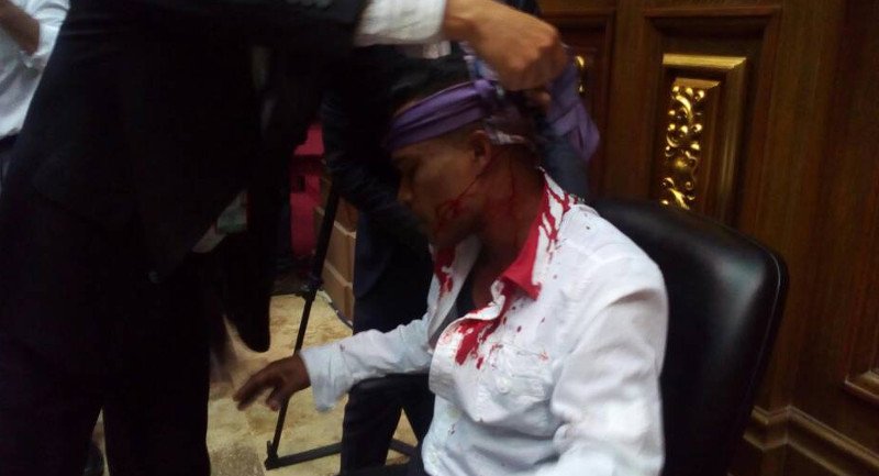 Βενεζουέλα: Οπαδοί του Μαδούρο εισέβαλαν στη Βουλή και τραυμάτισαν βουλευτές της αντιπολίτευσης [εικόνες] | iefimerida.gr 1