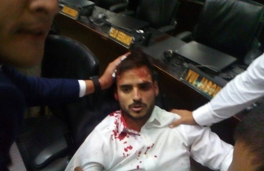 Βενεζουέλα: Οπαδοί του Μαδούρο εισέβαλαν στη Βουλή και τραυμάτισαν βουλευτές της αντιπολίτευσης [εικόνες] | iefimerida.gr 6