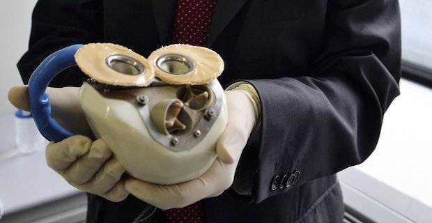 Πέθανε ο ασθενής στον οποίο έγινε η πρώτη μεταμόσχευση αυτόνομης τεχνητής καρδιάς | iefimerida.gr 1