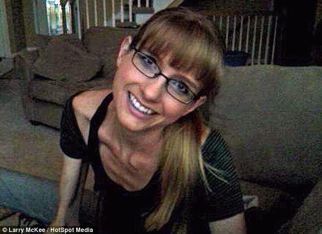 Μια υποσιτισμένη αδέσποτη γάτα την έσωσε από τη νευρική ανορεξία [εικόνες] | iefimerida.gr 1