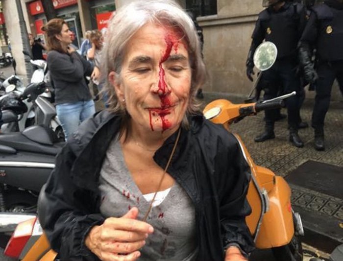 Οι εικόνες και τα βίντεο από το αιματοβαμμένο δημοψήφισμα στην Καταλονία, που σόκαραν τον πλανήτη -Ξύλο, πλαστικές σφαίρες, βία | iefimerida.gr 2